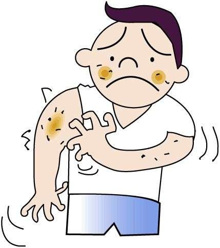 allergy